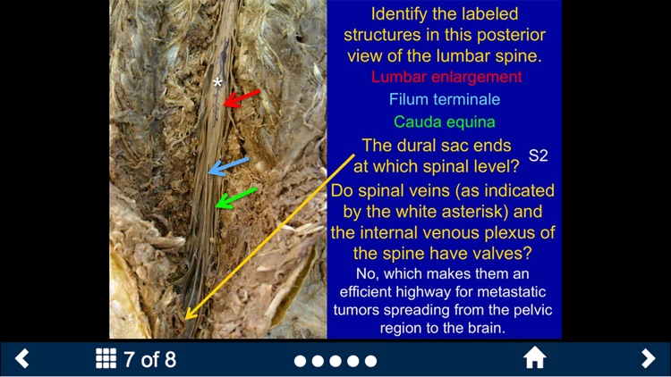 MSK Anatomy Lite - SecondLook screenshot-4
