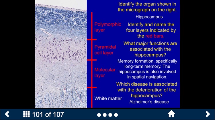 Neuroanatomy - SecondLook screenshot-3