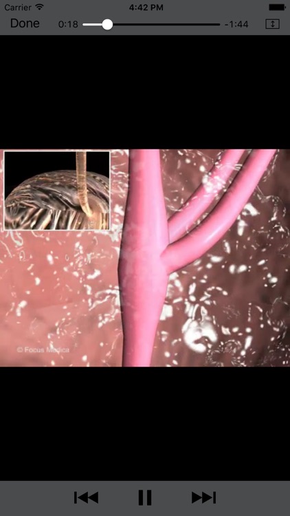 Oncology - Understanding Disease screenshot-3
