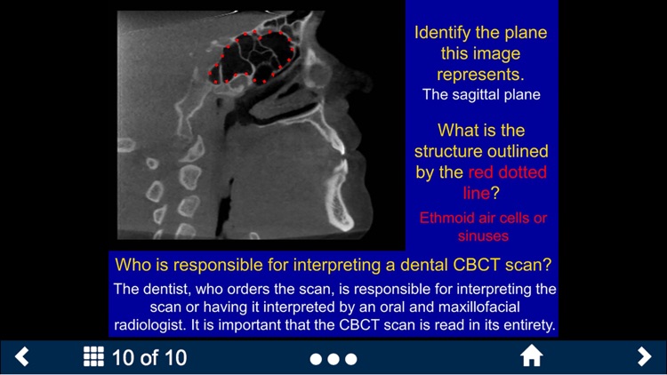 Oral Radiology Lite - SecondLook screenshot-4