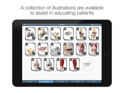 The Visual Consult: Knee Replacement screenshot 3