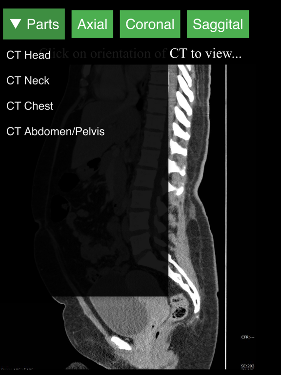 Radiology CT Viewer iPad screenshot 4 - Medical app