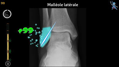 Screenshot #3 pour Anatomy Ninja Lower Limb