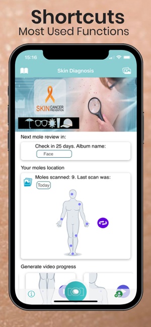 Mole Checker Skin Dermatology on the App Store