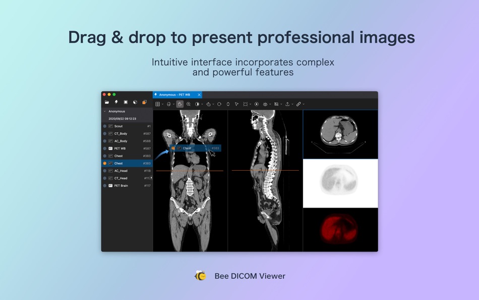 #1. Bee DICOM Viewer (macOS) 由: SinoUnion Healthcare Inc.