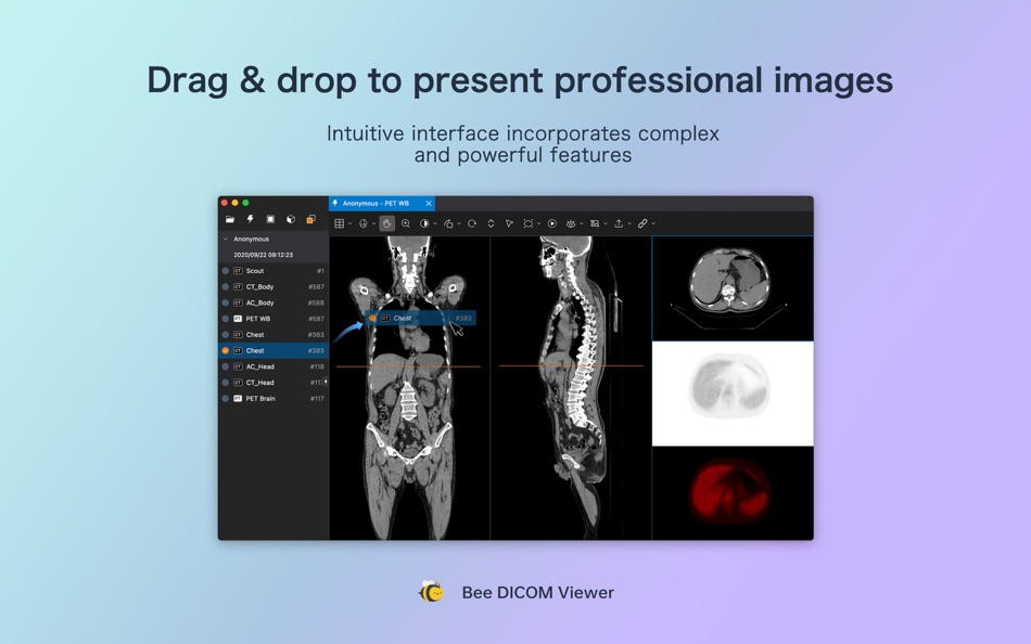 Bee DICOM Viewer - 2.5.1 - (macOS)