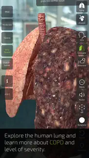 insight lung iphone screenshot 3