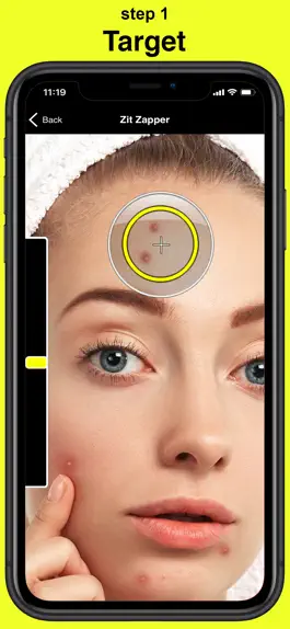 Game screenshot Zit Zapper - Remove Pimples apk