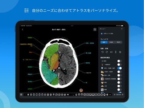 IMAIOS e-Anatomyのおすすめ画像6