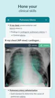 amboss medical knowledge iphone screenshot 3