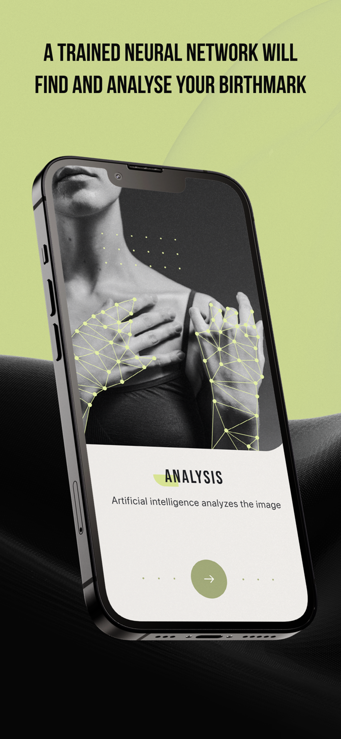 CUBE-Check Ur Birthmark Easily