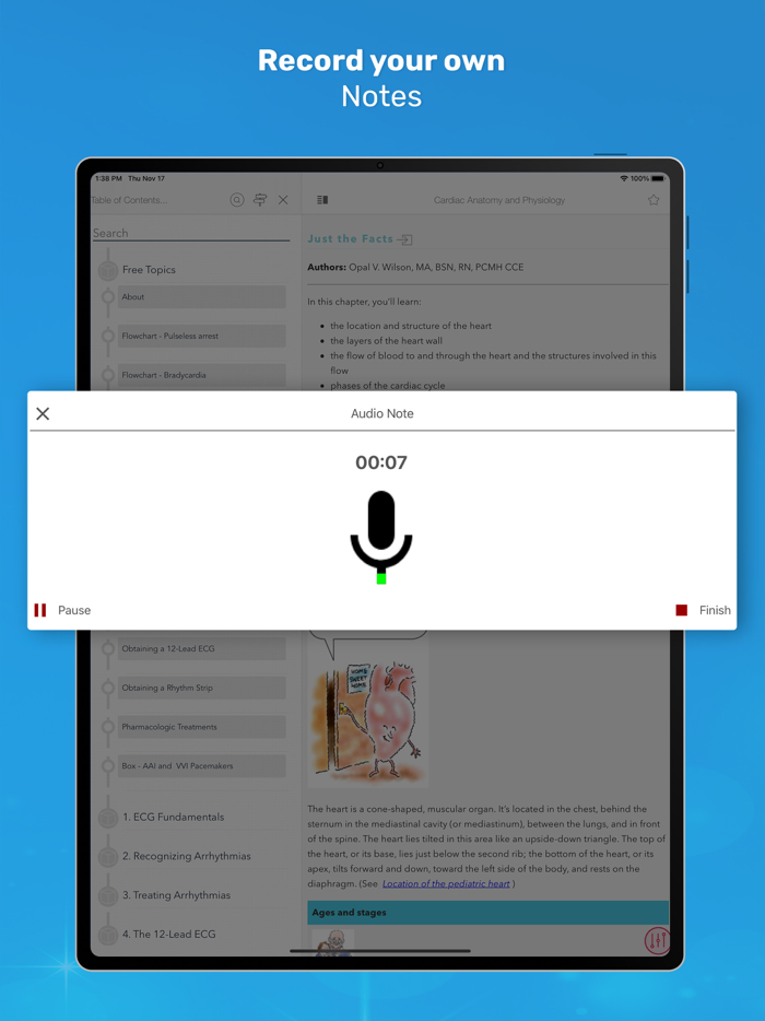 ECG Interpretation MIE