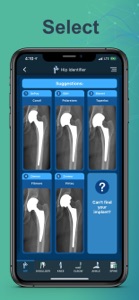 Implant Identifier screenshot #5 for iPhone