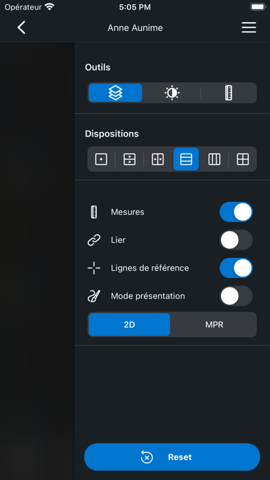 Screenshot #3 pour IDV - IMAIOS DICOM Viewer