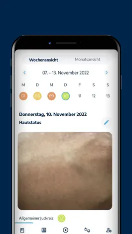 Game screenshot Neurodermitis App NALA hack