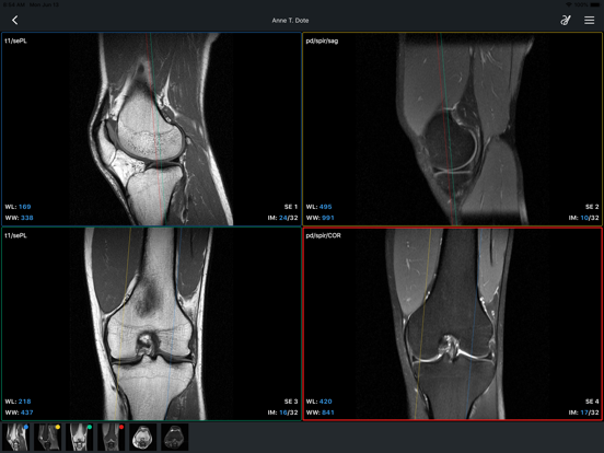 Screenshot #6 pour IDV - IMAIOS DICOM Viewer