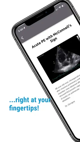 Game screenshot The POCUS Atlas apk