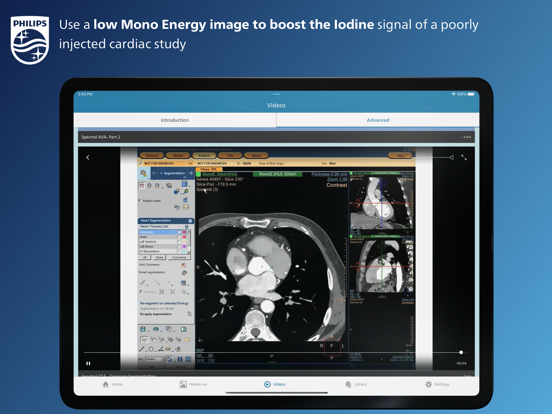 Philips CT Learning screenshot 3