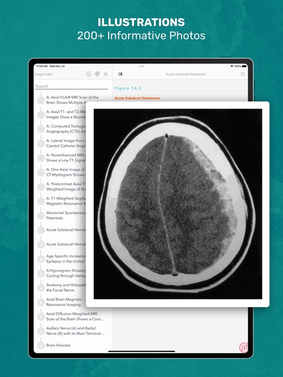 Screenshot #6 pour CURRENT Dx Tx Neurology