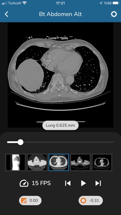 Medatto screenshot-4