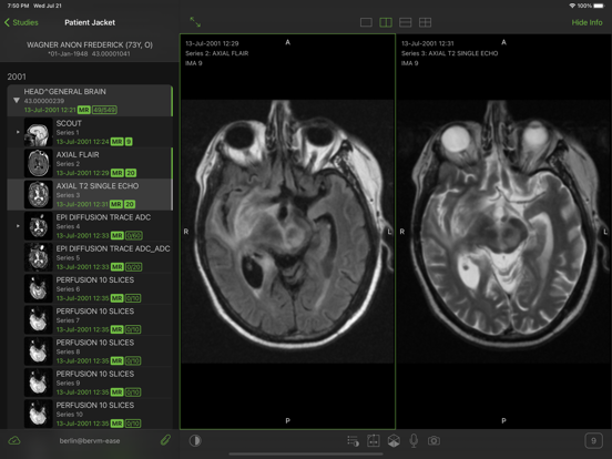 Visage Ease Pro iPad screenshot 4 - Medical app