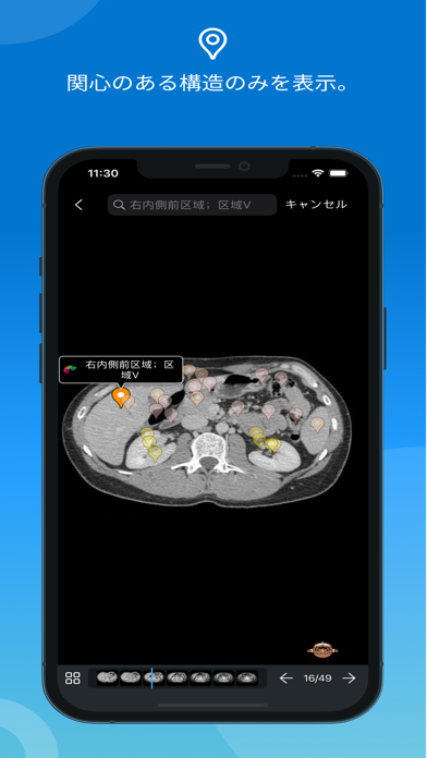 IMAIOS e-Anatomyスクリーンショット