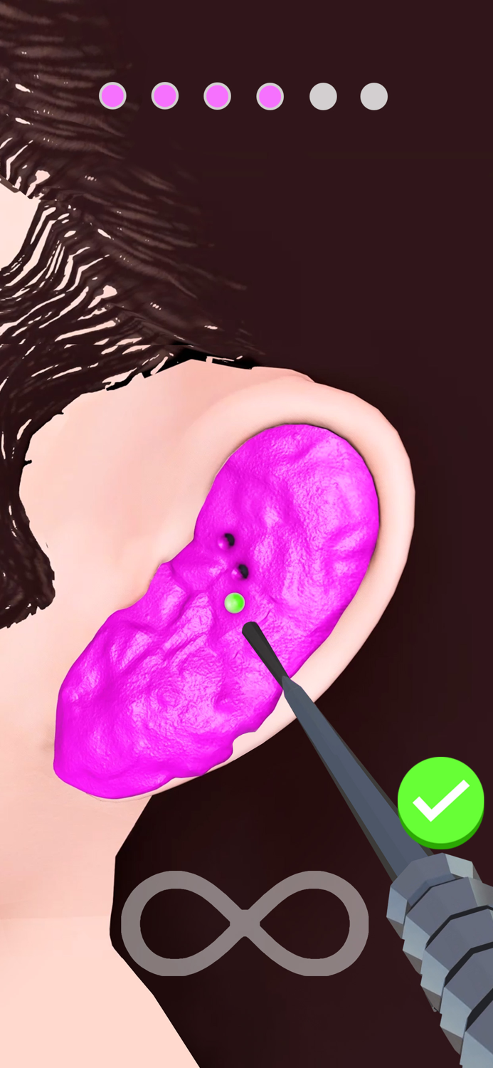 Earwax Removal