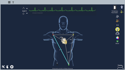 Epicardio Heart Simulatorのおすすめ画像7