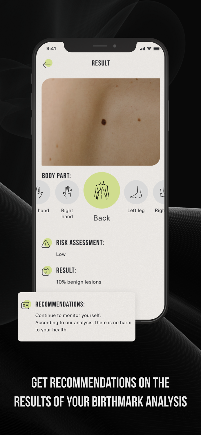 CUBE-Check Ur Birthmark Easily