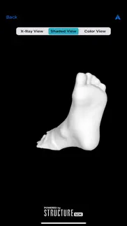How to cancel & delete 3dfootscan - structure sdk 1