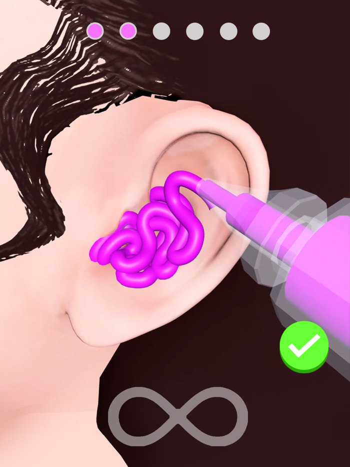 Earwax Removal