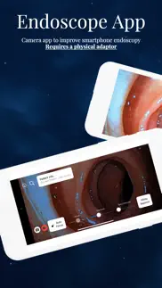 endoscope app iphone screenshot 1