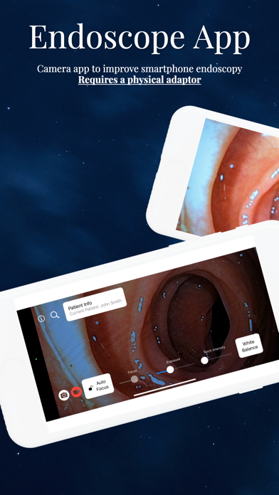 Endoscope App Screenshot