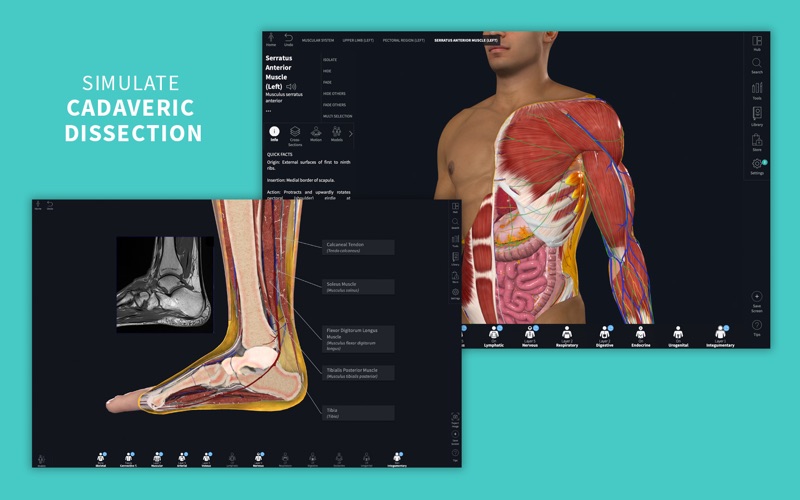 Screenshot #2 for Complete Anatomy 24