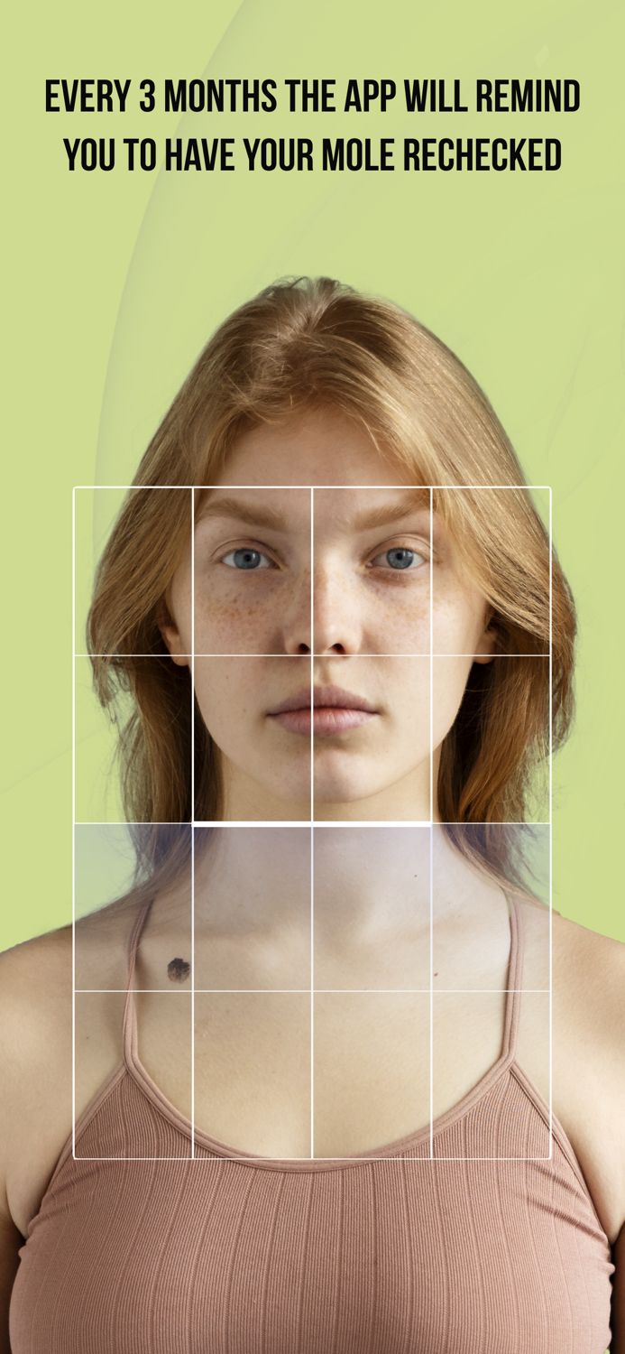 CUBE-Check Ur Birthmark Easily