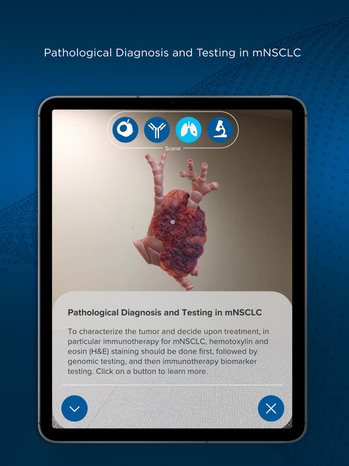 ImmerseRx mNSCLC Immunotherapy