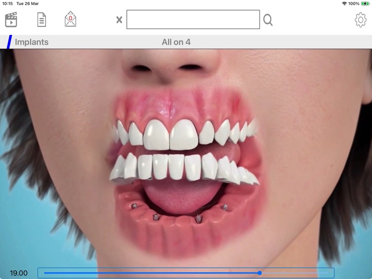 MEDiVision Communicator