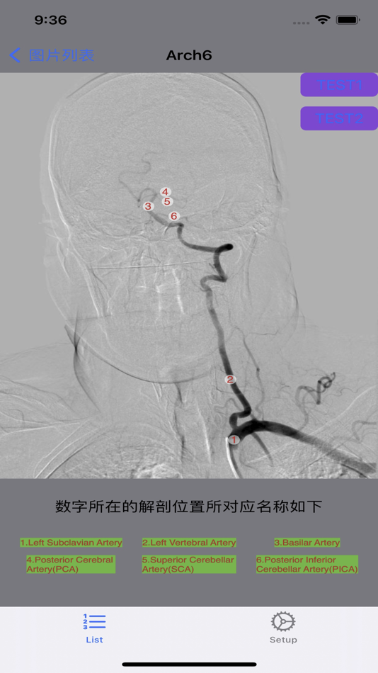 #8. 脑血管学习 (iOS) 게시자: 艺 张