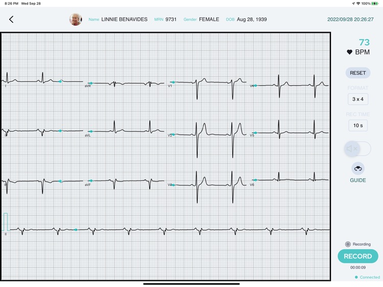 EKGenius screenshot-4