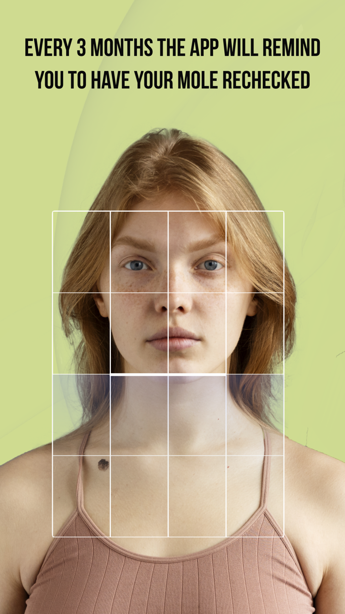 CUBE-Check Ur Birthmark Easily