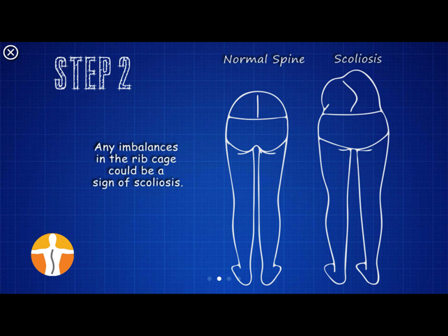 Tangkapan Layar Skoliometer