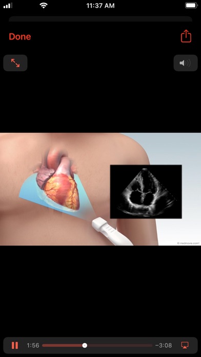 Hx Heart Screenshot