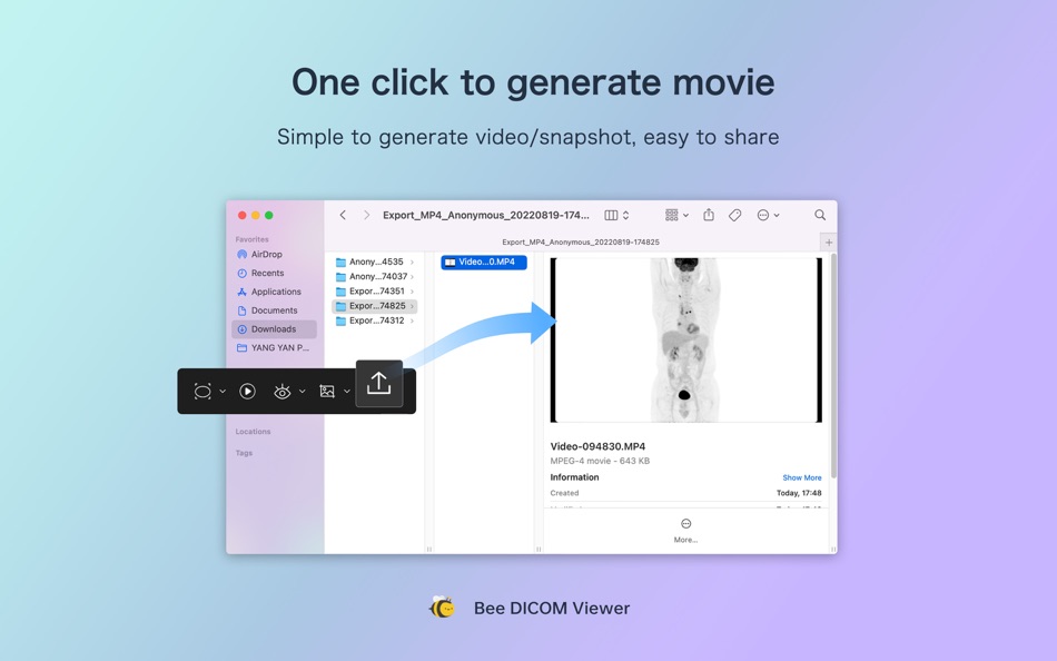 #4. Bee DICOM Viewer (macOS) 由: SinoUnion Healthcare Inc.