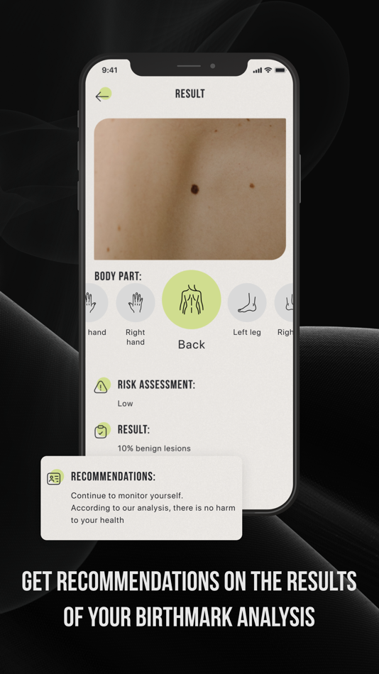 #4. CUBE-Check Ur Birthmark Easily (iOS) By: Yuri Korkhau