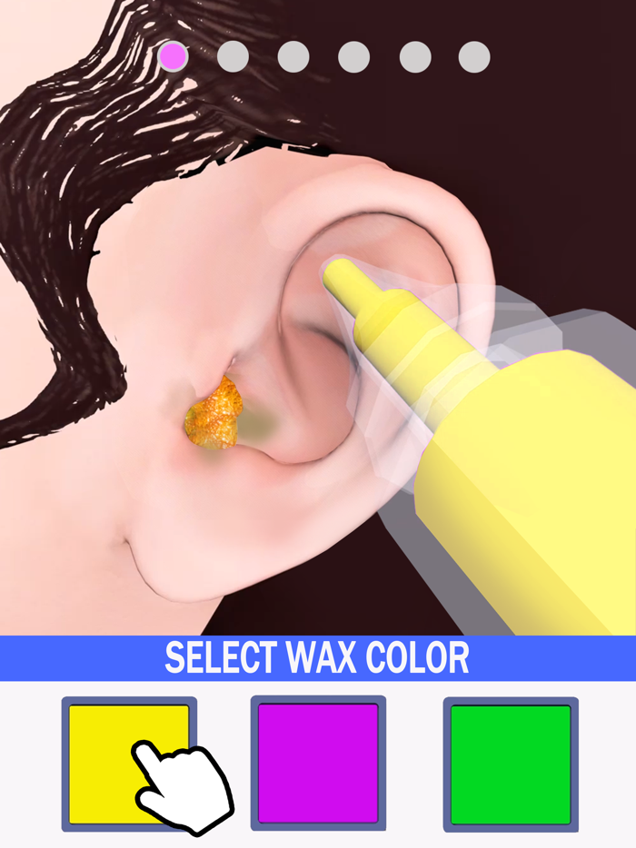 Earwax Removal