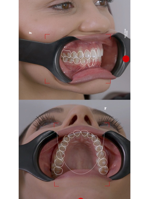 Dental Shooting v2のおすすめ画像1