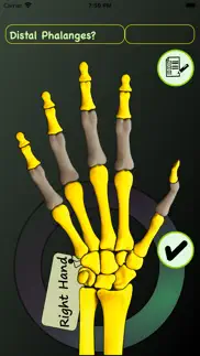 hand bones: speed anatomy quiz problems & solutions and troubleshooting guide - 2