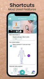 How to cancel & delete mole checker skin dermatology 4