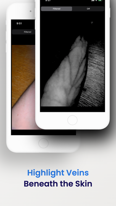 VeinSeek Proのおすすめ画像1
