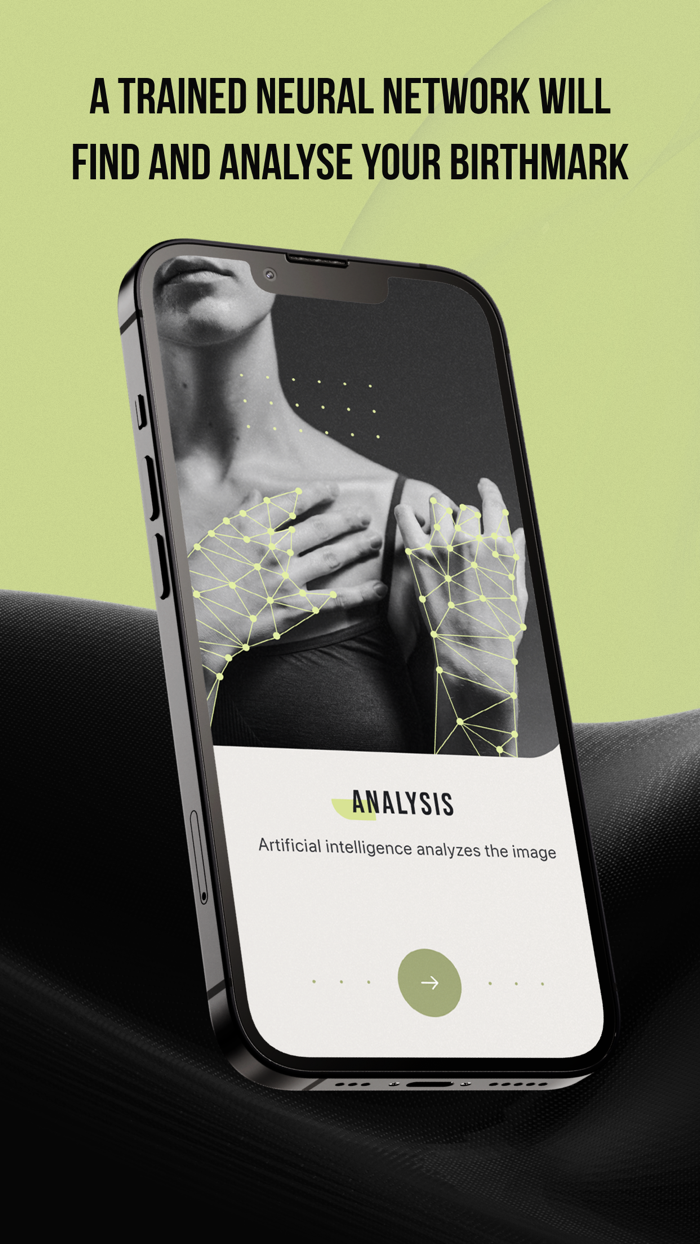 CUBE-Check Ur Birthmark Easily